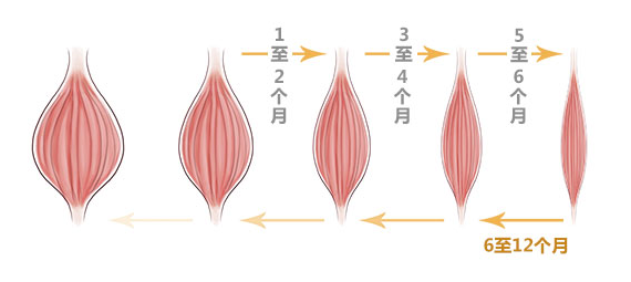 廣州美萊瘦臉能維持多久