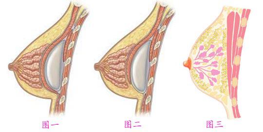 長(zhǎng)沙自體脂肪豐胸能維持多長(zhǎng)時(shí)間