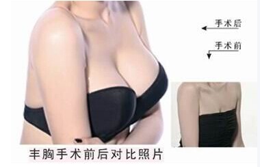 有什么辦法讓乳房變美呢？