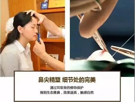 這種鼻子做了鼻整形