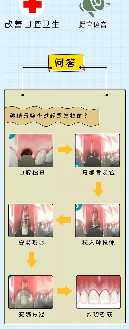 牙齒矯正可以用一輩子嗎？