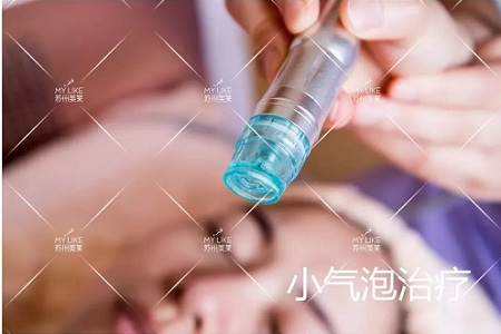 黑頭和白頭