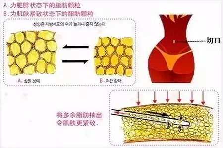 四月不吸脂，五、六、七月徒傷悲......