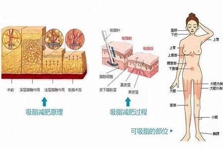 四月不吸脂，五、六、七月徒傷悲......