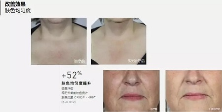 抗衰老的“水光”究竟為何飽受稱贊？