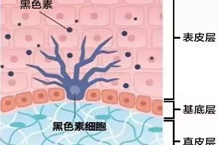 祛斑偏方“害死人”，小仙女們可長點心吧！