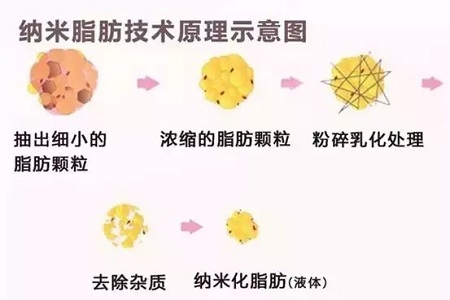 拿什么拯救你，我的黑眼圈？