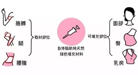 腿再瘦一點(diǎn)？腰再細(xì)一點(diǎn)？胸再大一點(diǎn)？自體脂肪填充，一步到位！