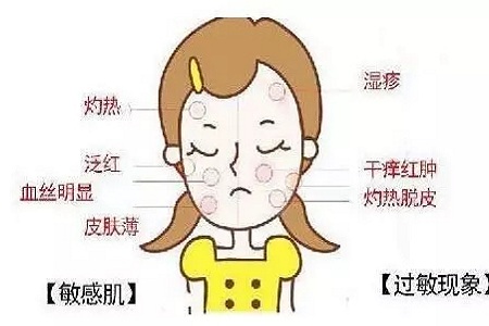 皮膚變成敏感肌怎么辦？如何修復(fù)敏感肌？