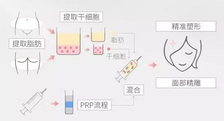 美萊實驗室：瘦臉、ReFa都解決不了你的臉大問題交給我就對了