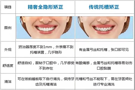 這種牙齒矯正方式，96%的人都會選擇！