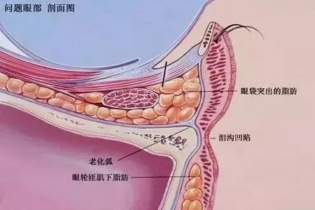 顯老淚溝，你還要任其放肆嗎？