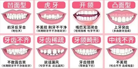 有效數(shù)據(jù)生成，預(yù)見(jiàn)牙齒矯正后的自己