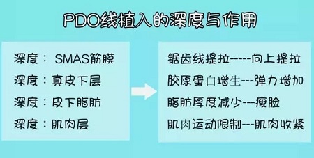 關于*雕，你想了解的都在這里！