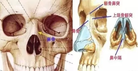 側(cè)面看鼻梁不矮,正面看鼻子卻很塌是什么原因？