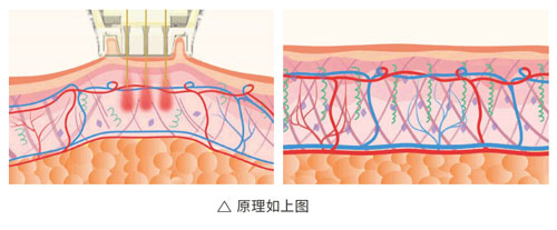 超光子+水光，“撐起”皮膚彈、潤(rùn)、緊